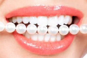 HGC Dental. Blanqueig dental dents sensibles.