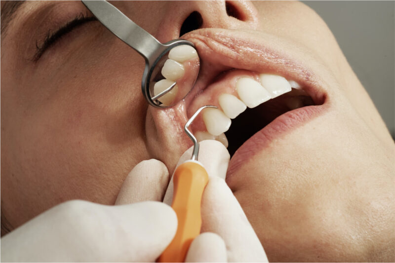 HGC Dental: servei d'implantologia dental a Terrassa