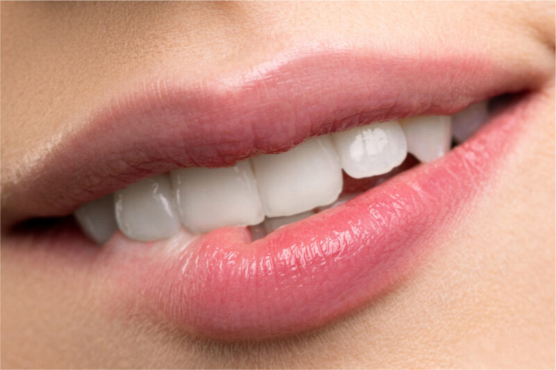 HGC Dental. Servicio de tratamiento de bruxismo dental en Terrassa