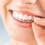 Transforma el teu somriure amb Invisalign. HGC Dental Terrassa