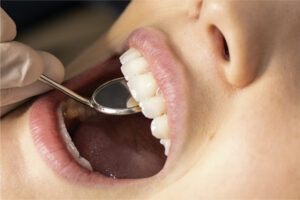 HGC Dental. Servicio de cirugía oral en Terrassa. Cirugía de encías.